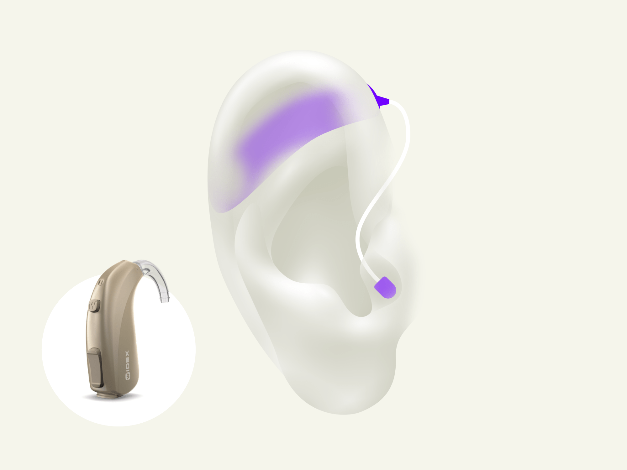 BTE behind-the-ear hearing aid is sits behind your ear with rechargeable battery