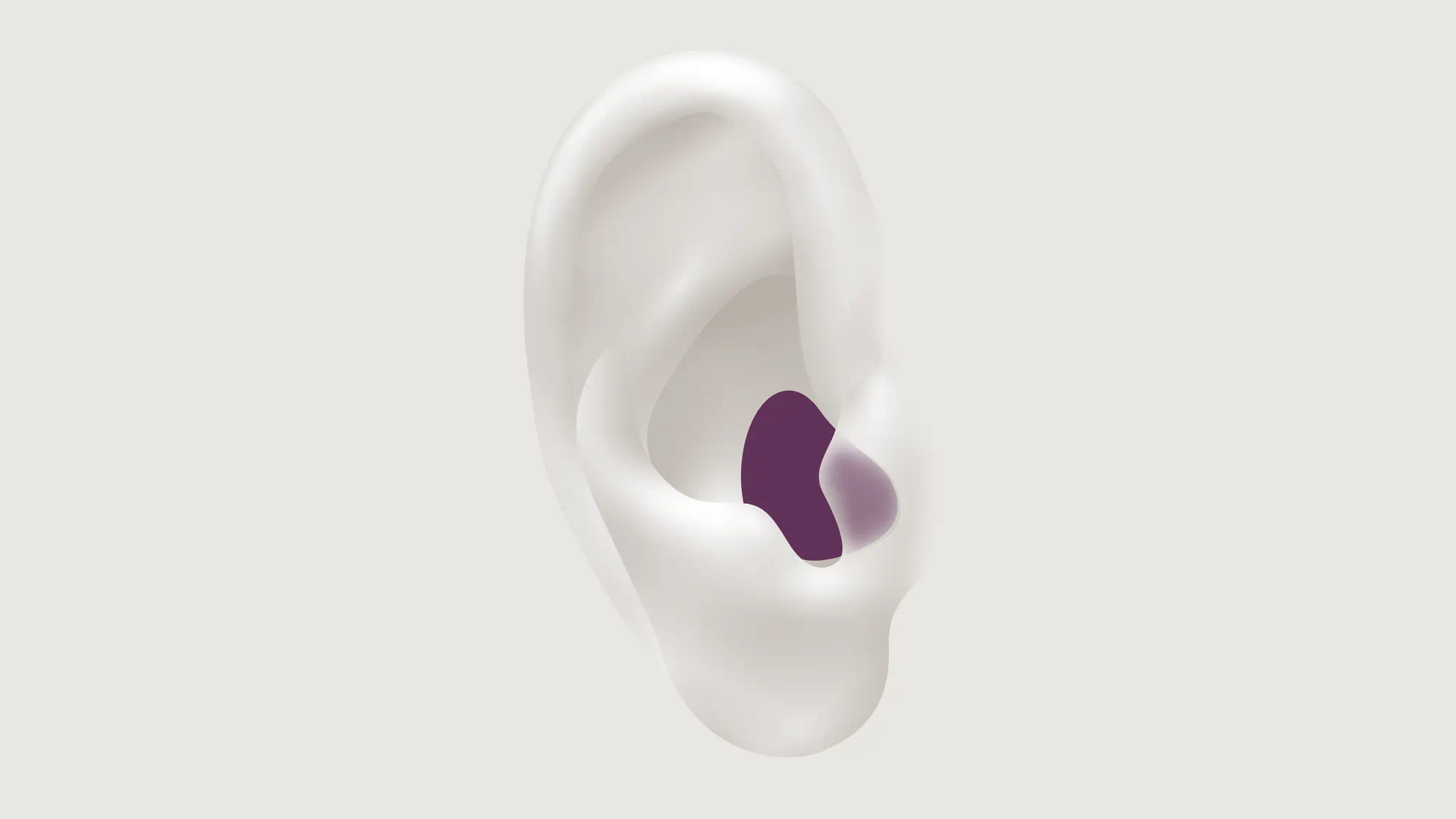 Illustration showing the types of hearing aid called ITE which is worn in the canal.