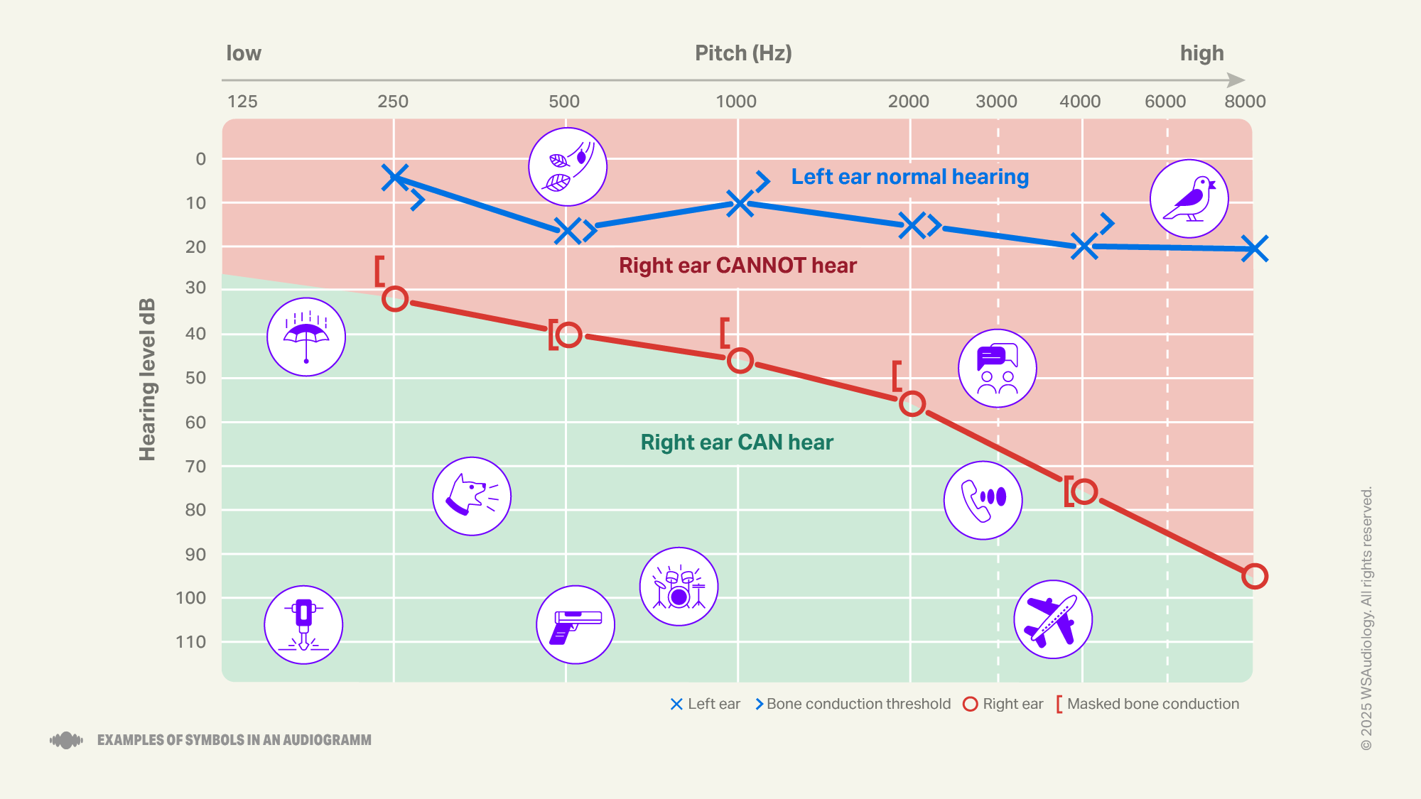 Example of symbols in an audiogram