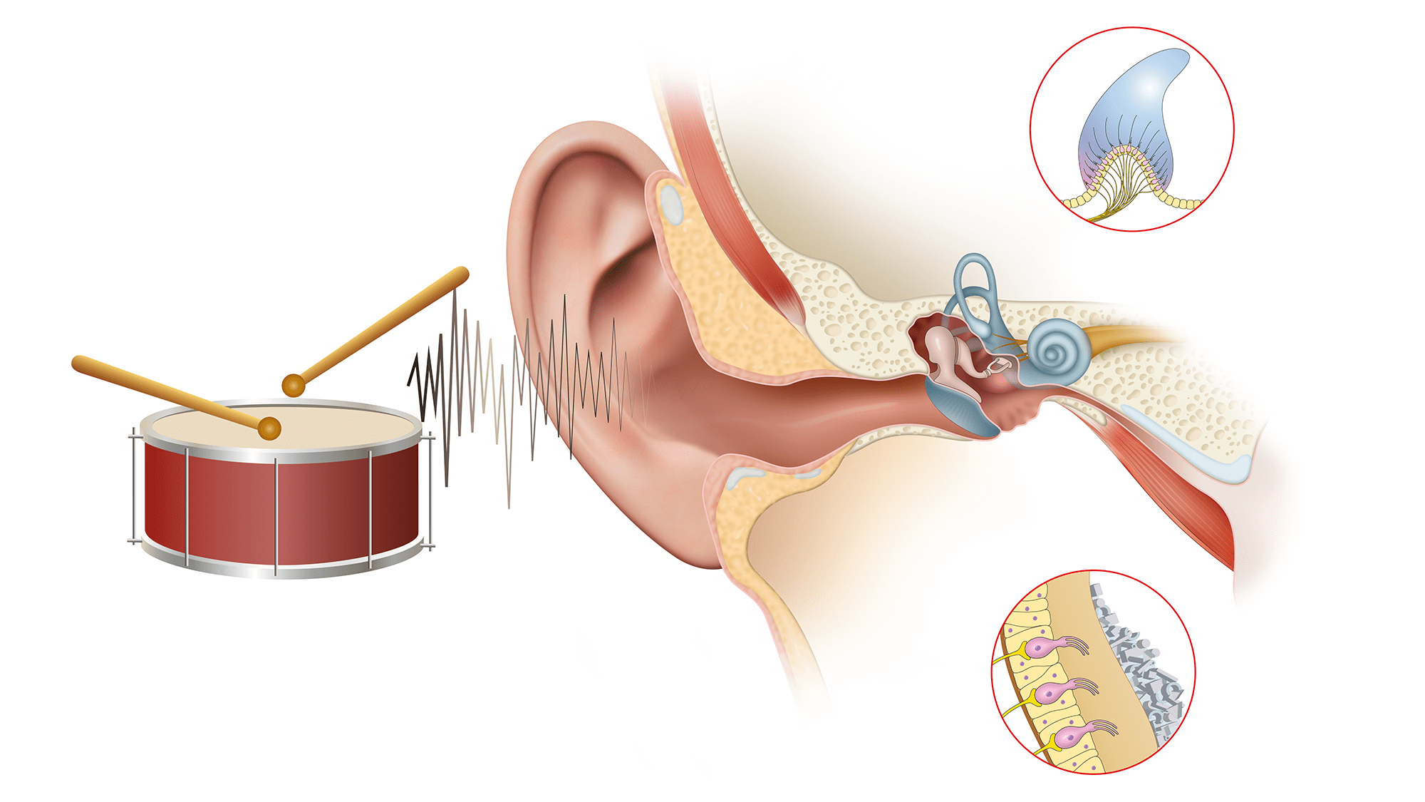 Ear and sound waves - agerelated hearing loss