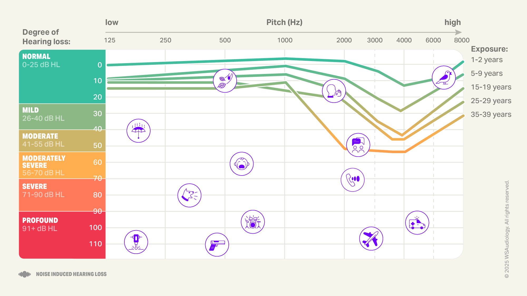 Noise induced hearing loss audiogram