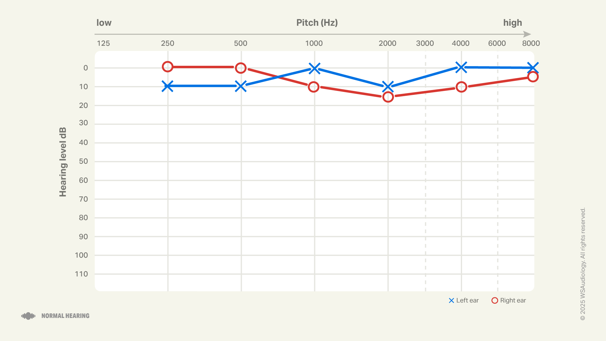 Normal hearing audiogram