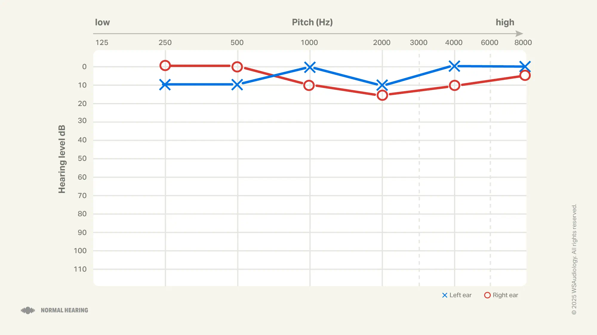 Normal hearing audiogram