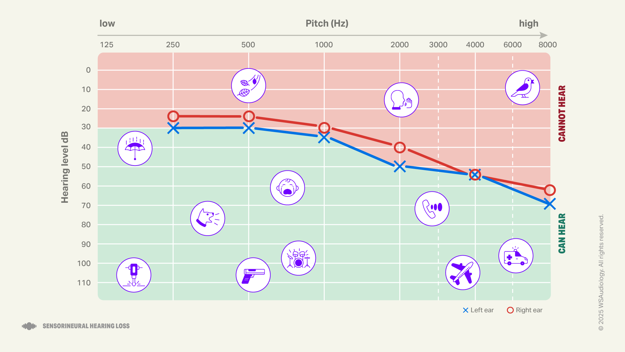 Sensorineural hearing loss audiogram