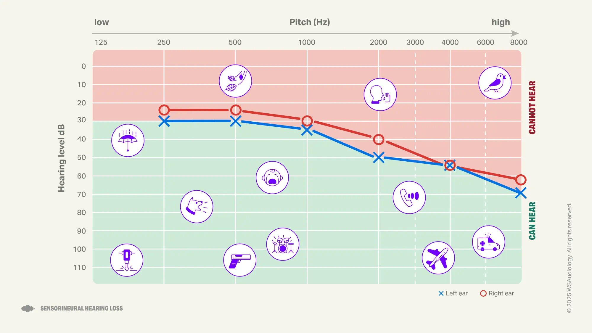 Sensorineural hearing loss audiogram