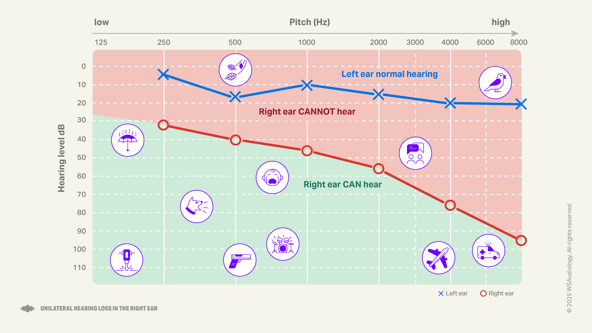 Unilateral audiogram
