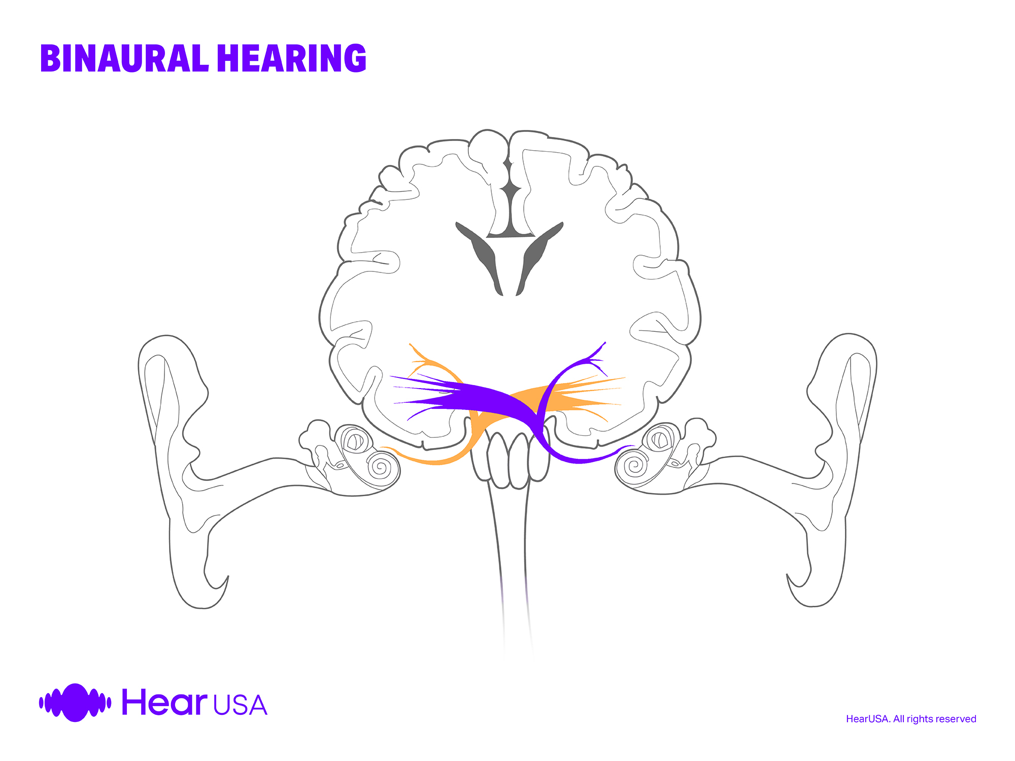 Binaural hearing
