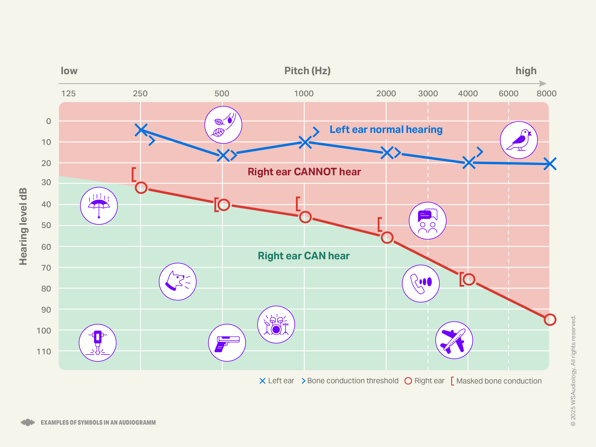 Example of symbols audiogram