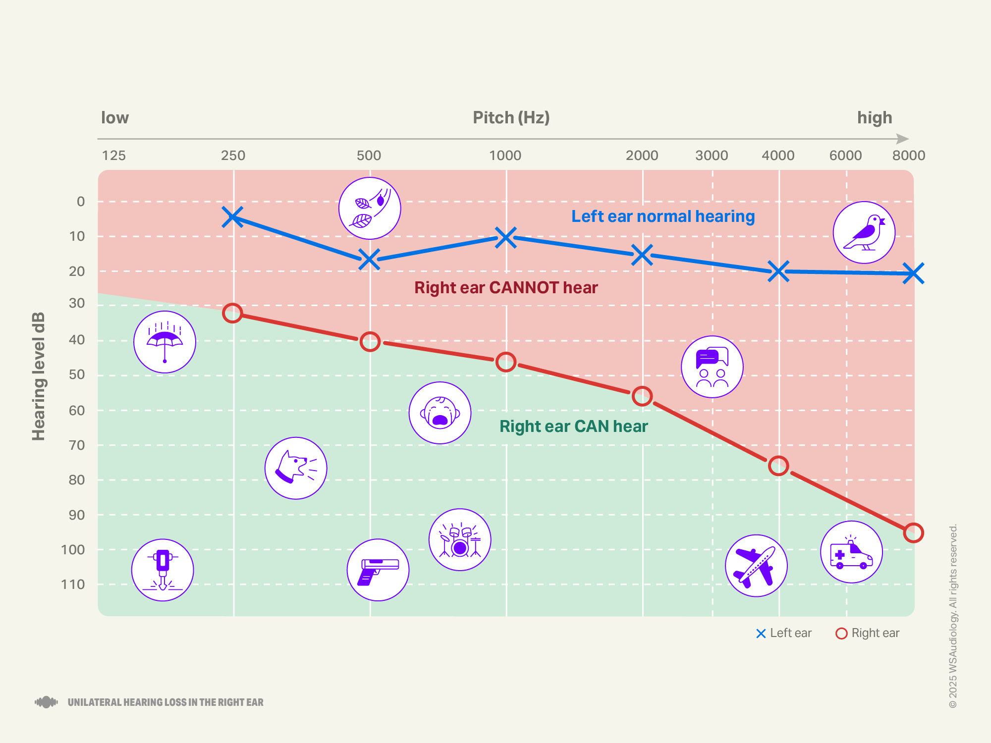 Unilateral audiogram