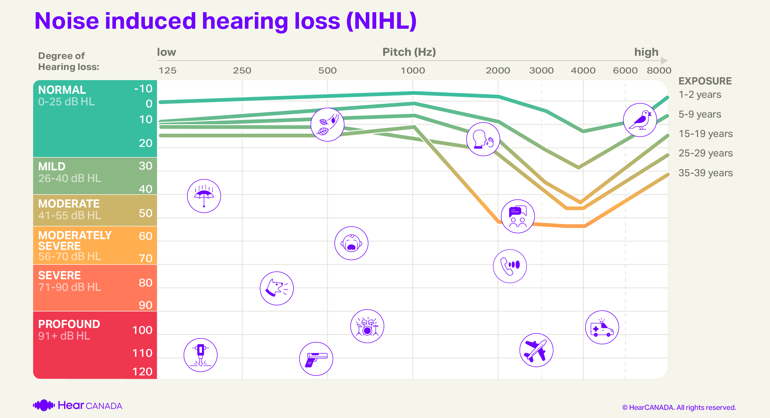 Noise Induced hearing loss audiogram