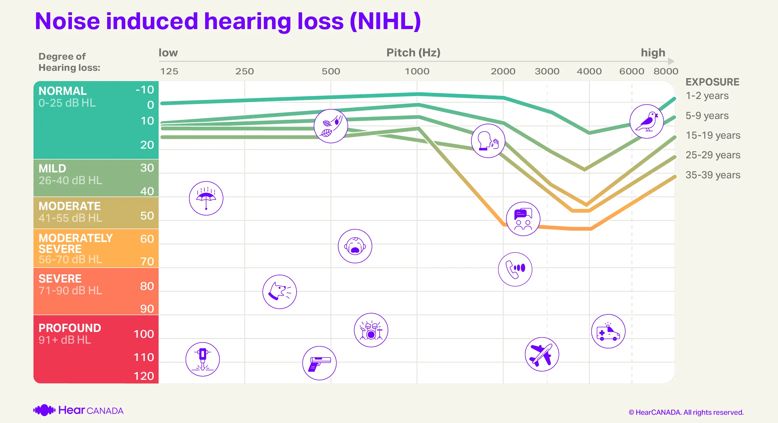 Noise Induced Hearing Loss Noise Induced Hearing Loss Prevented By