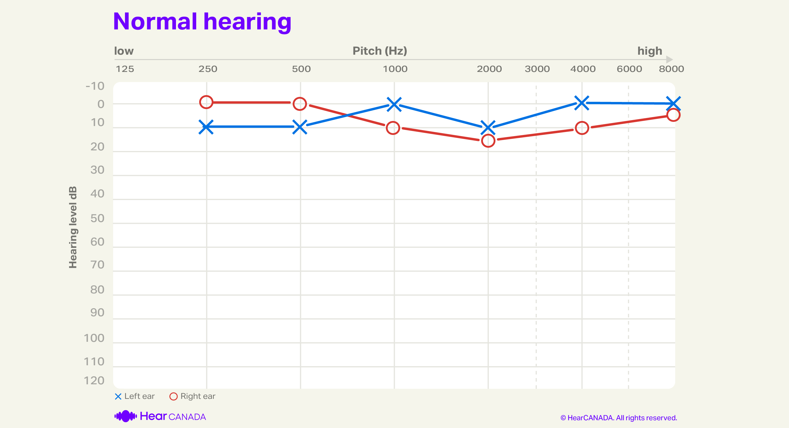 Normal hearing audiogram