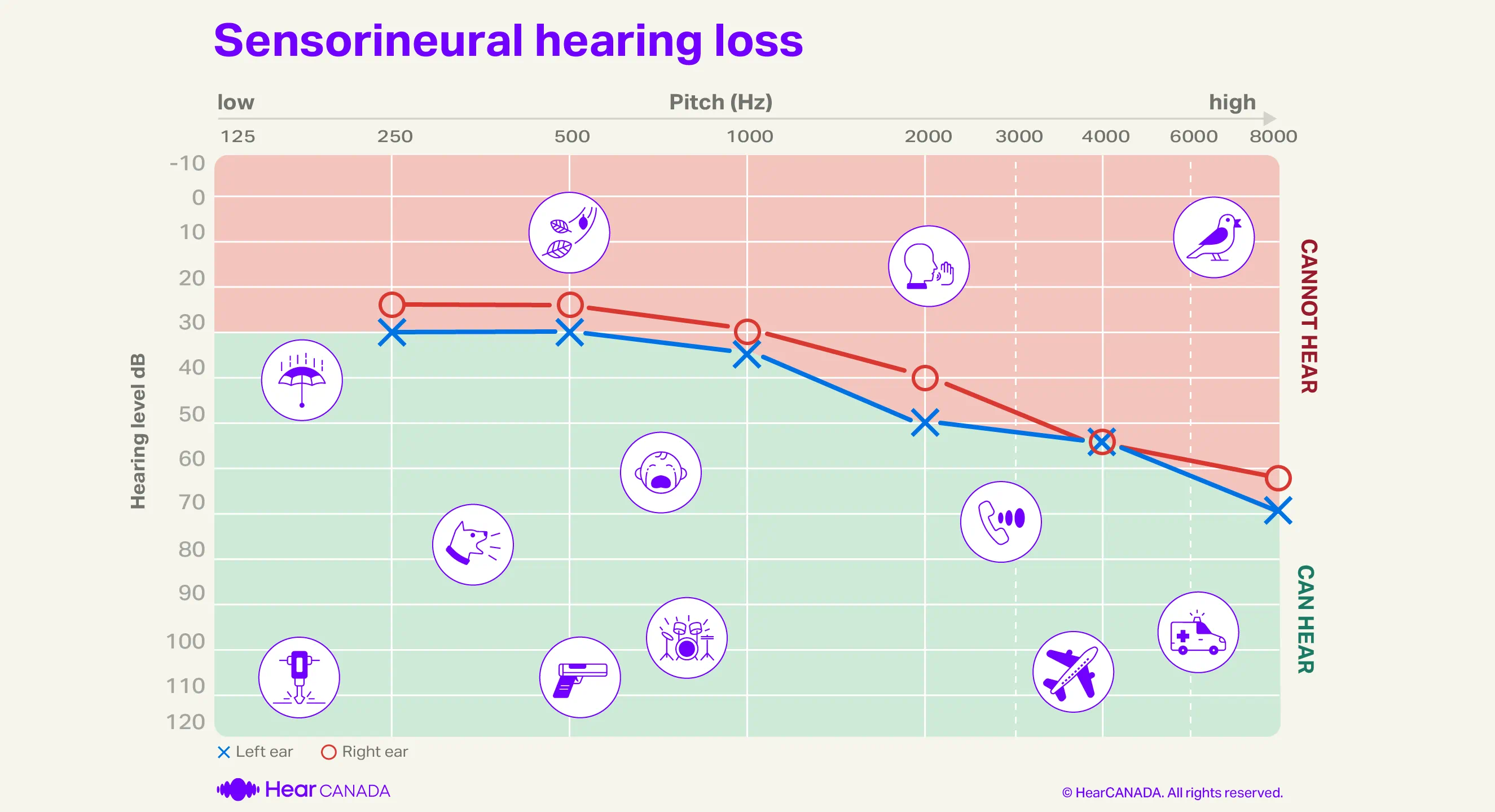 Sensorineural hearing loss audiogram