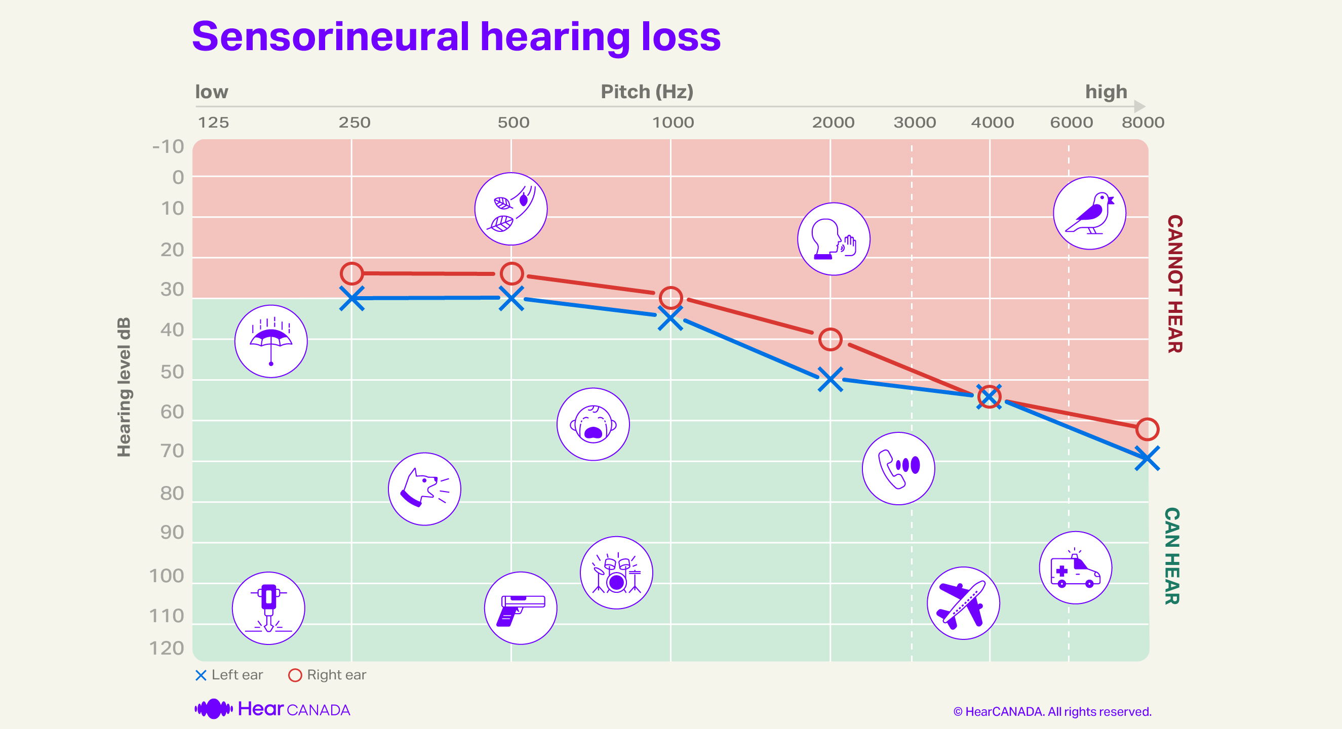 Sensorineural hearing loss audiogram