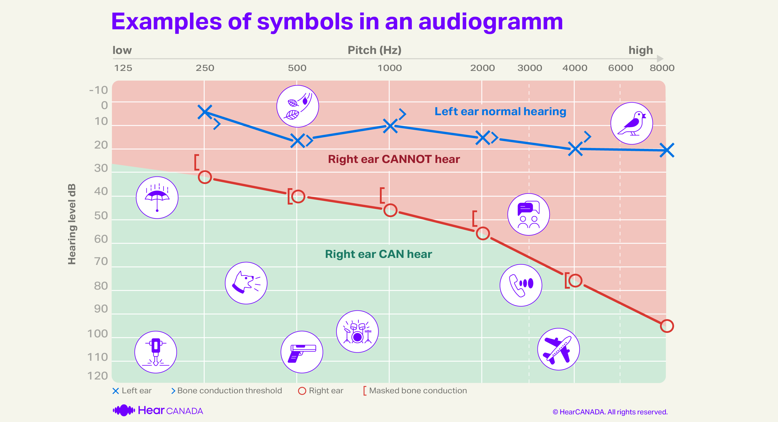 Example of symbols audiograms