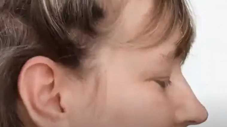 remove-a-motion-charge-and-go-p-from-the-ear-16x9