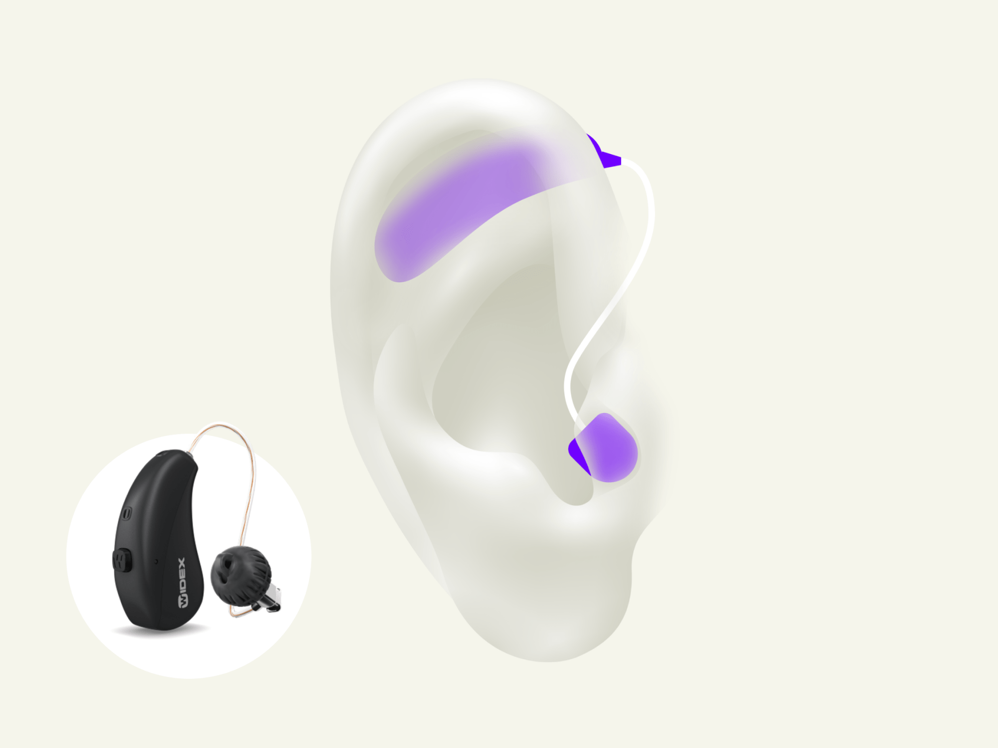 ric hearing aids
