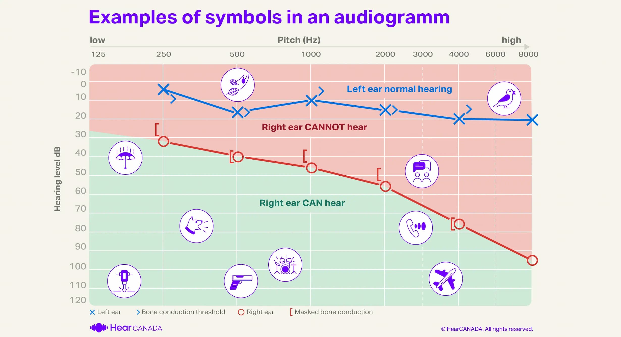 Symbols on audiogram