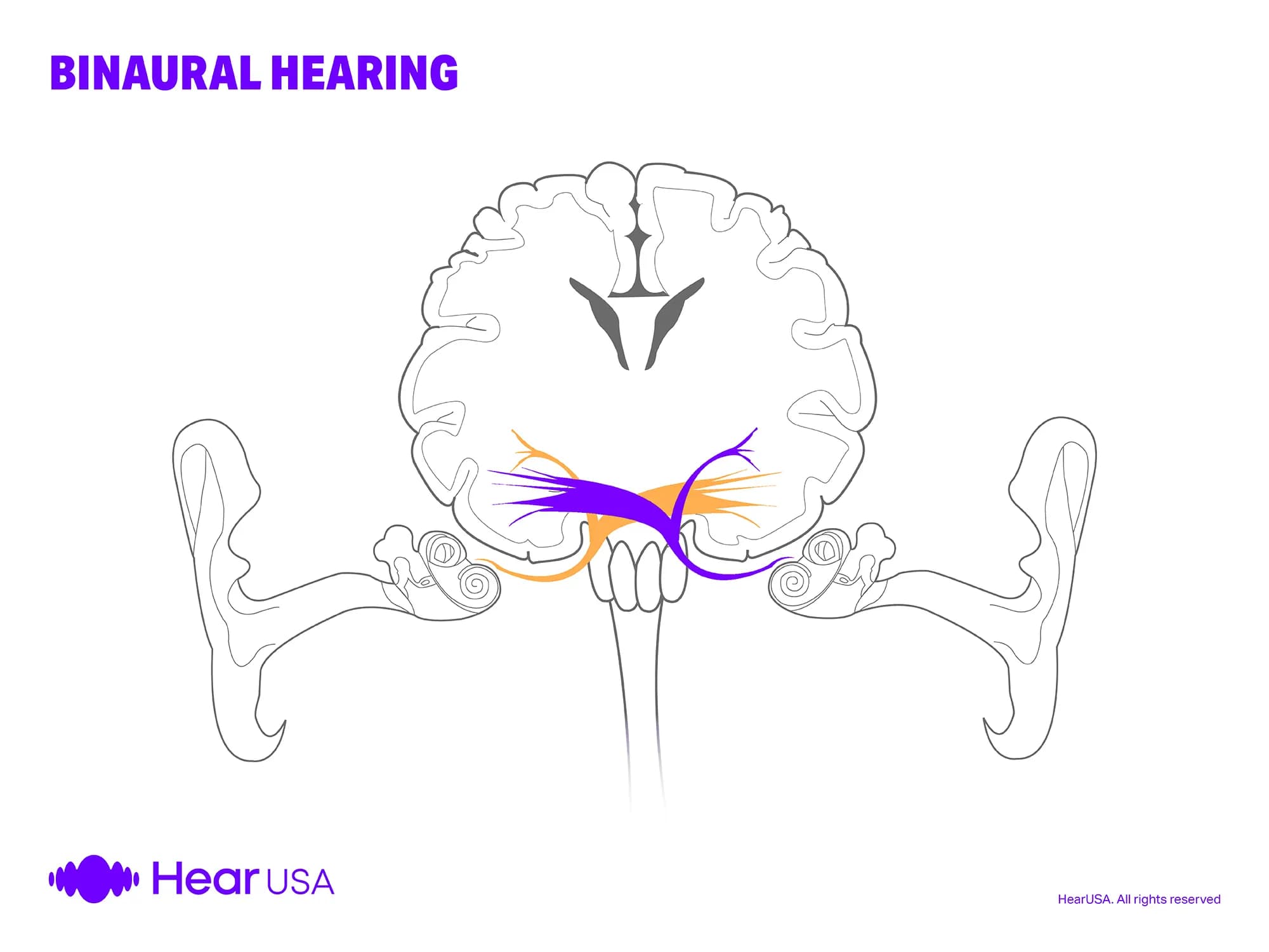 Binaural hearing