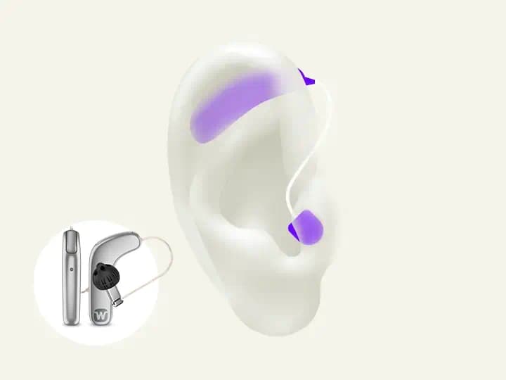 image of Widex Smart In Canal Hearing Aid